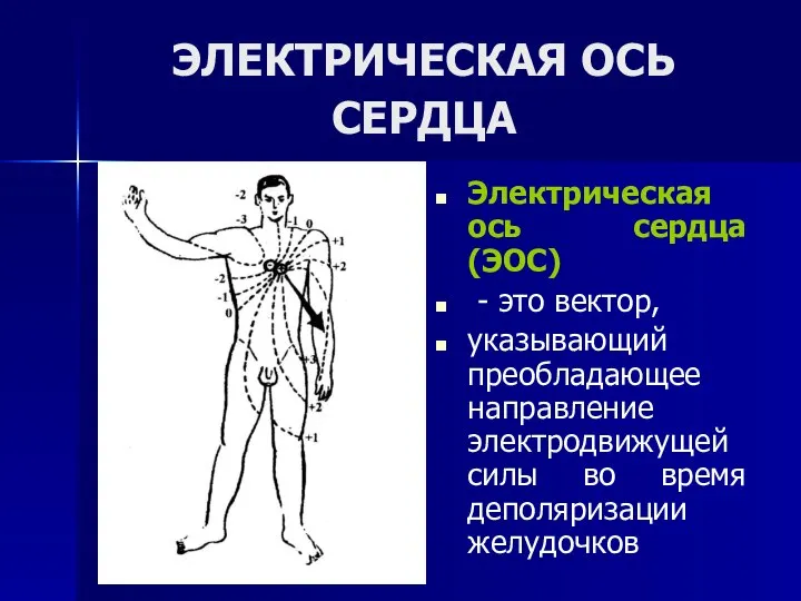 ЭЛЕКТРИЧЕСКАЯ ОСЬ СЕРДЦА Электрическая ось сердца (ЭОС) - это вектор, указывающий