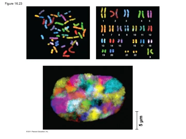 Figure 16.23 5 μm