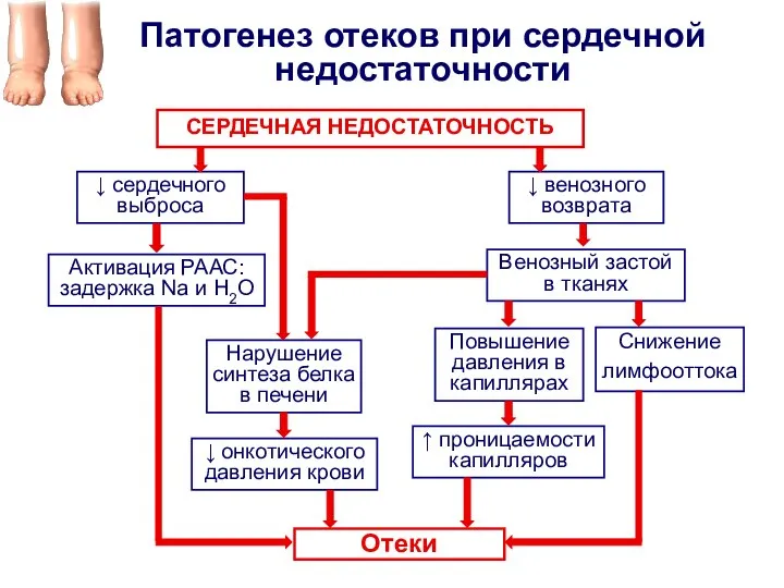 Патогенез отеков при сердечной недостаточности