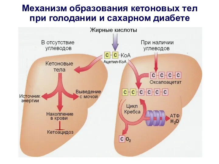 Механизм образования кетоновых тел при голодании и сахарном диабете