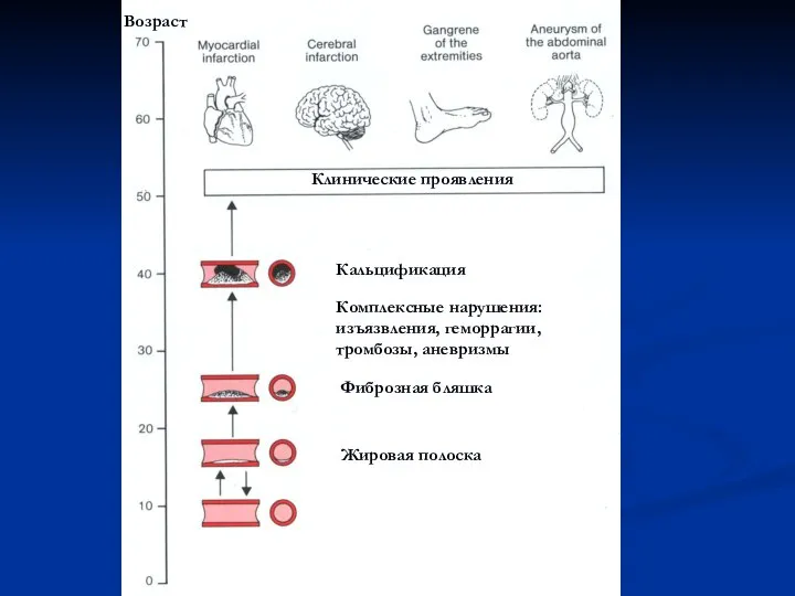 Возраст Жировая полоска Фиброзная бляшка Комплексные нарушения: изъязвления, геморрагии, тромбозы, аневризмы Кальцификация Клинические проявления