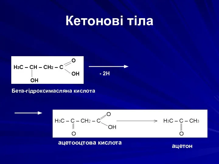 Кетонові тіла Бета-гідроксимасляна кислота - 2Н ацетооцтова кислота ацетон -СО2