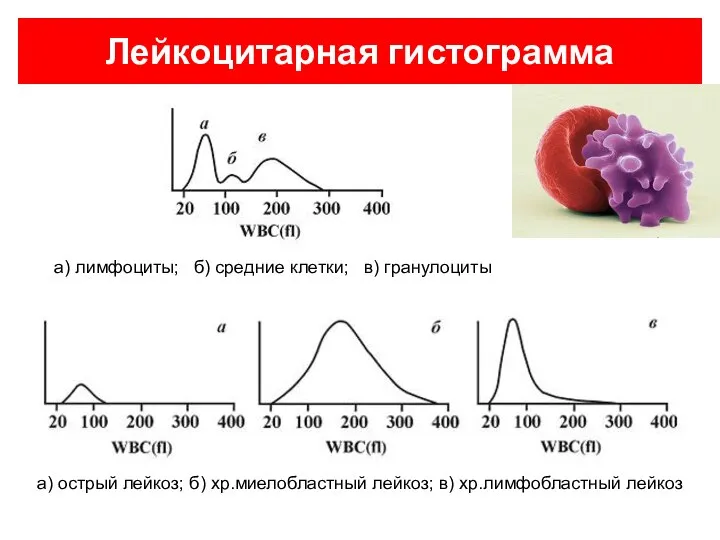 а) лимфоциты; б) средние клетки; в) гранулоциты Лейкоцитарная гистограмма а) острый