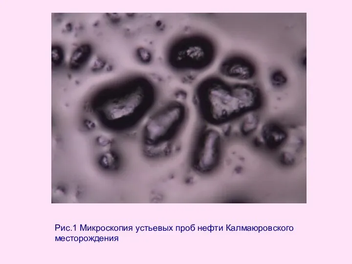 Рис.1 Микроскопия устьевых проб нефти Калмаюровского месторождения