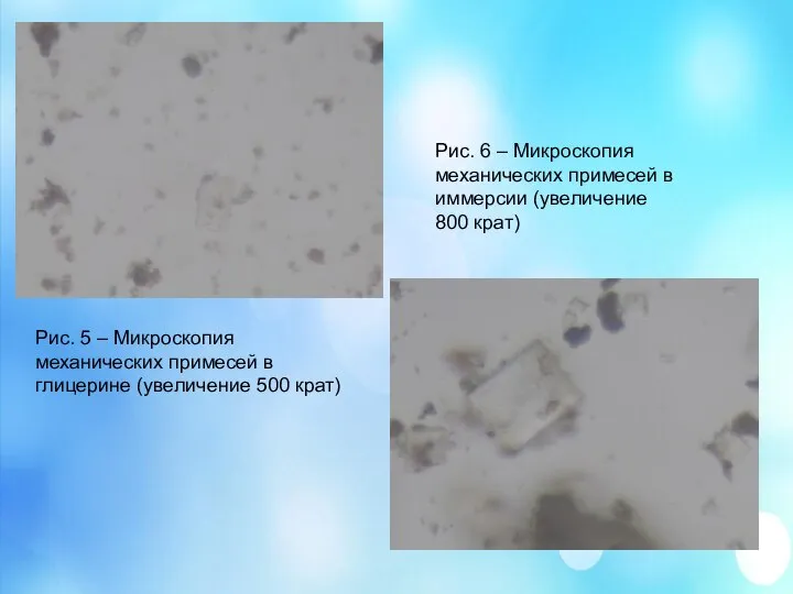 Рис. 5 – Микроскопия механических примесей в глицерине (увеличение 500 крат)