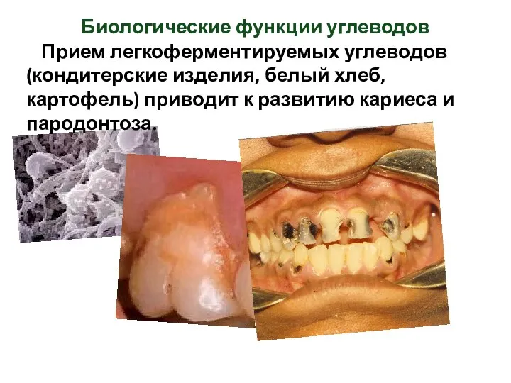 Прием легкоферментируемых углеводов (кондитерские изделия, белый хлеб, картофель) приводит к развитию