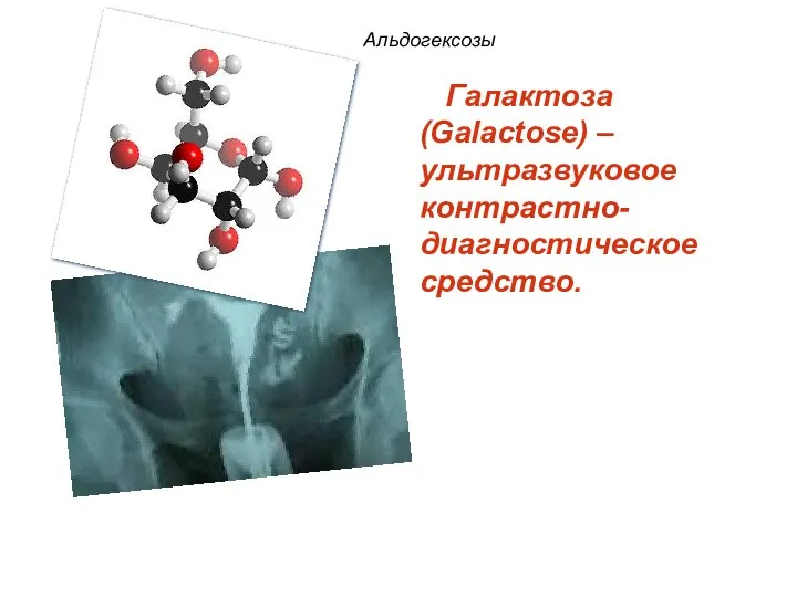 Альдогексозы Галактоза (Galactose) – ультразвуковое контрастно-диагностическое средство.