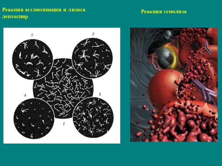 Реакция агглютинации и лизиса лептоспир Реакция гемолиза