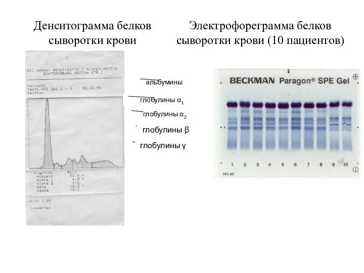 альбумины глобулины α1 глобулины α2 глобулины β глобулины γ