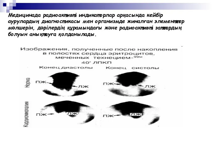 Медицинада радиоактивті индикаторлар арқасында кейбір аурулардың диагностикасы мен организмде жиналған элементтер