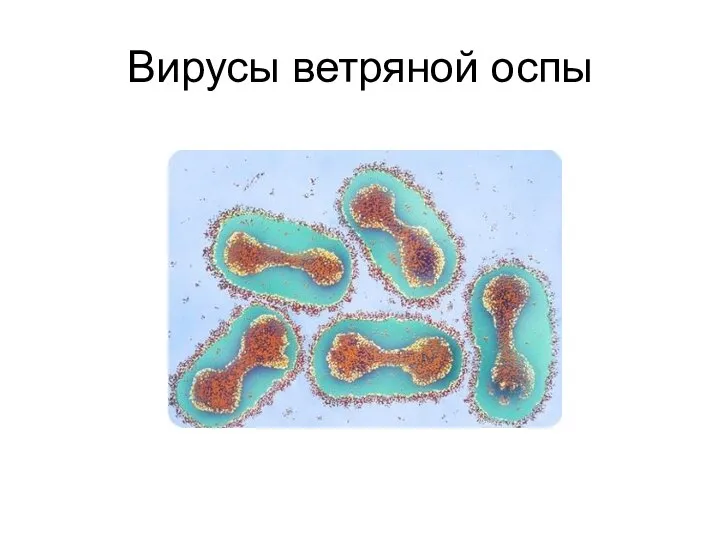 Вирусы ветряной оспы