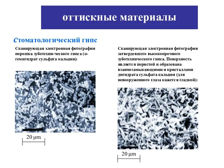 20 μm 20 μm Сканирующая электронная фотография порошка зуботехни-ческого гипса (α-гемигидрат