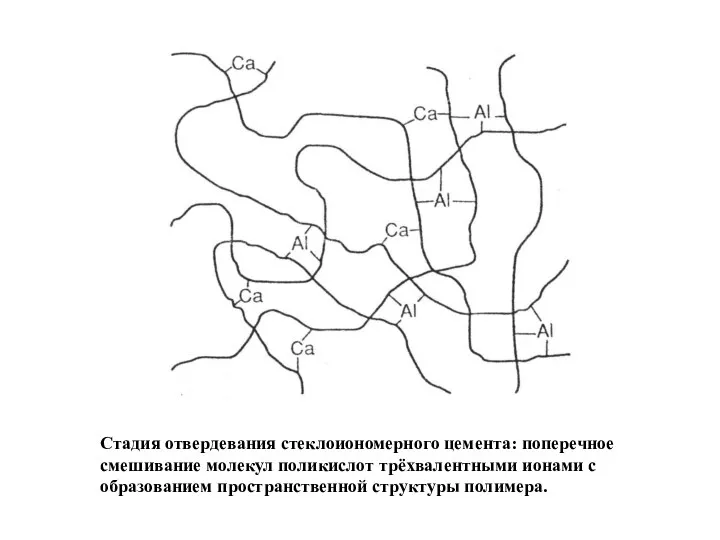 Стадия отвердевания стеклоиономерного цемента: поперечное смешивание молекул поликислот трёхвалентными ионами с образованием пространственной структуры полимера.