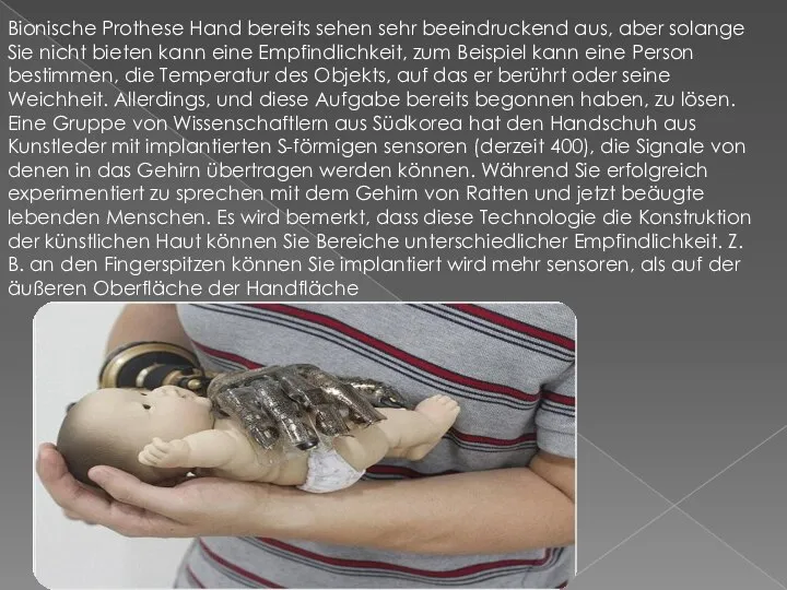 Bionische Prothese Hand bereits sehen sehr beeindruckend aus, aber solange Sie