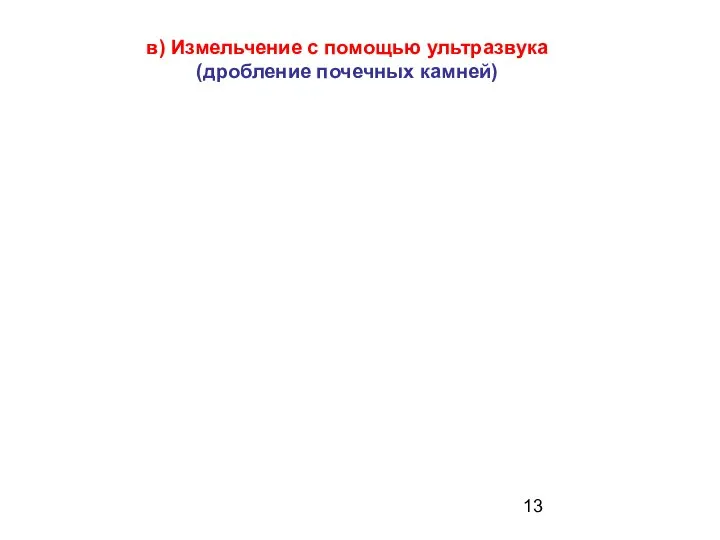 в) Измельчение с помощью ультразвука (дробление почечных камней)