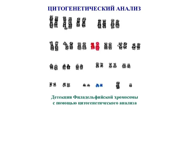 ЦИТОГЕНЕТИЧЕСКИЙ АНАЛИЗ Детекция Филадельфийской хромосомы с помощью цитогенетического анализа