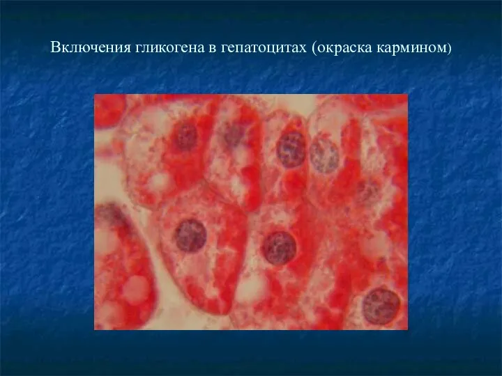 Включения гликогена в гепатоцитах (окраска кармином)‏