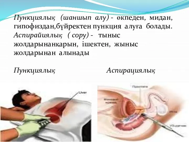 Пункциялық (шаншып алу) - өкпеден, мидан, гипофиздан,бүйректен пункция алуға болады. Аспирайиялық