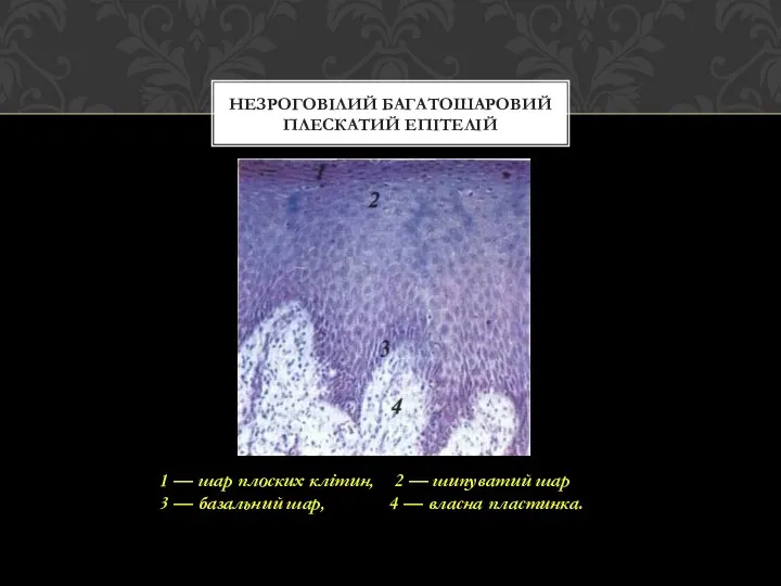 НЕЗРОГОВІЛИЙ БАГАТОШАРОВИЙ ПЛЕСКАТИЙ ЕПІТЕЛІЙ 1 — шар плоских клітин, 2 —