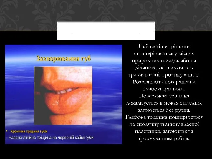 Найчастіше тріщини спостерігаються у місцях природних складок або на ділянках, які