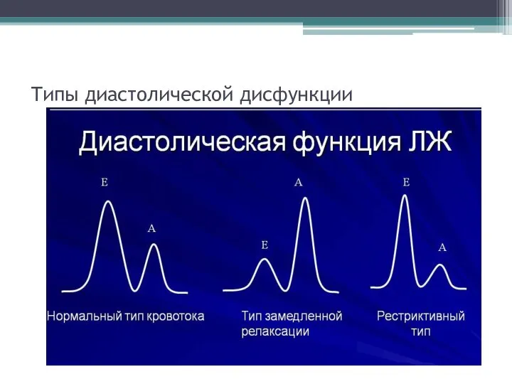 Типы диастолической дисфункции