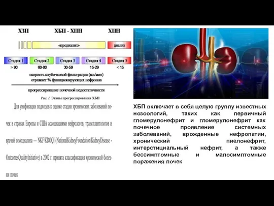 ХБП включает в себя целую группу известных нозоологий, таких как первичный