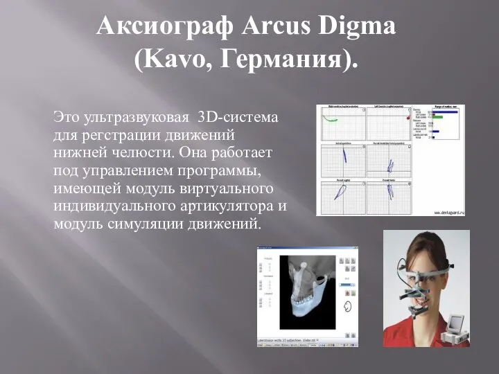 Аксиограф Arcus Digma (Kavo, Германия). Это ультразвуковая 3D-система для регстрации движений