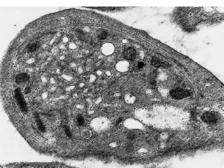 Electron micrograph of a platelet sectioned in the equatorial plane showing