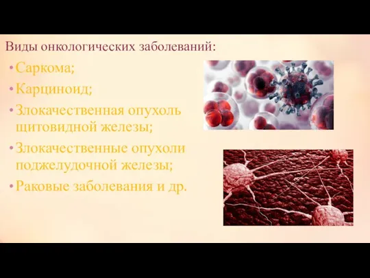 Виды онкологических заболеваний: Саркома; Карциноид; Злокачественная опухоль щитовидной железы; Злокачественные опухоли