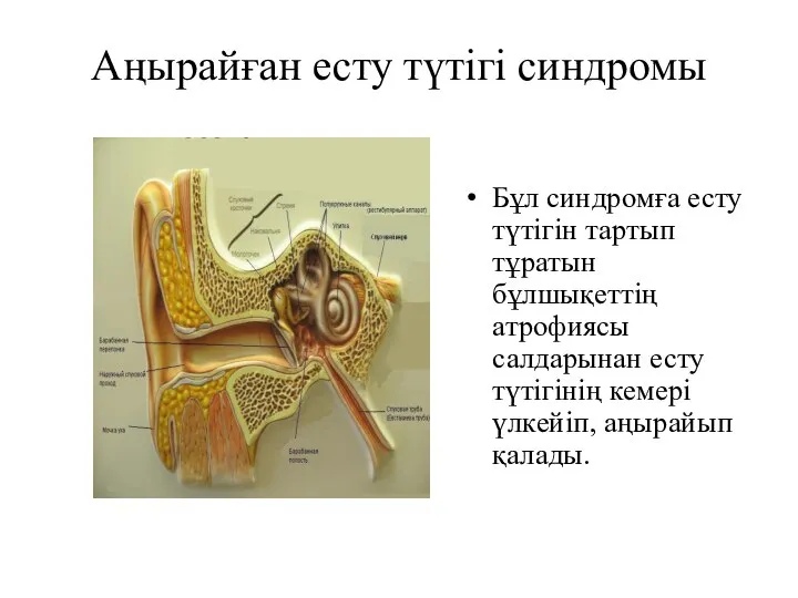 Аңырайған есту түтігі синдромы Бұл синдромға есту түтігін тартып тұратын бұлшықеттің