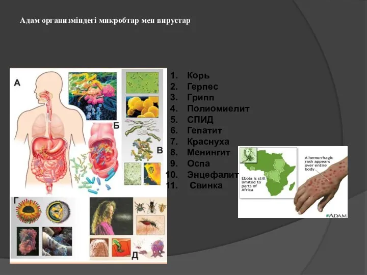 Адам организміндегі микробтар мен вирустар Корь Герпес Грипп Полиомиелит СПИД Гепатит Краснуха Менингит Оспа Энцефалит Свинка