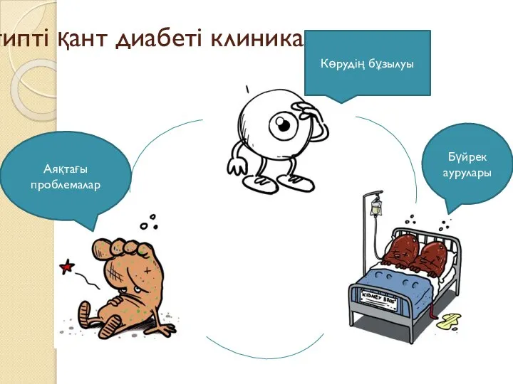 ІІ типті қант диабеті клиникасында Көрудің бұзылуы Аяқтағы проблемалар Бүйрек аурулары