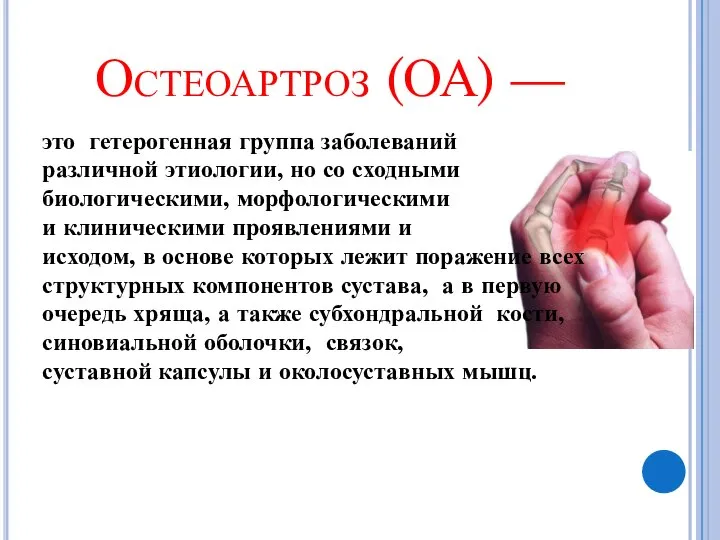 Остеоартроз (ОА) — это гетерогенная группа заболеваний различной этиологии, но со