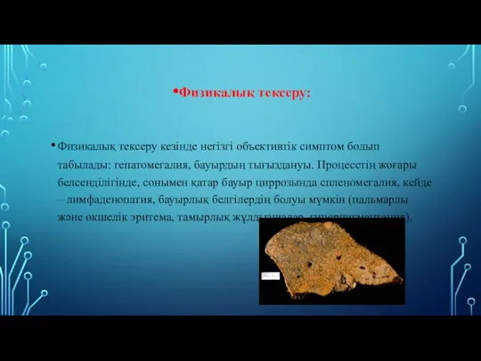 Физикалық тексеру: Физикалық тексеру кезінде негізгі объективтік симптом болып табылады: гепатомегалия,