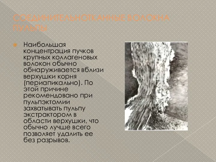 СОЕДИНИТЕЛЬНОТКАННЫЕ ВОЛОКНА ПУЛЬПЫ Наибольшая концентрация пучков крупных коллагеновых волокон обычно обнаруживается