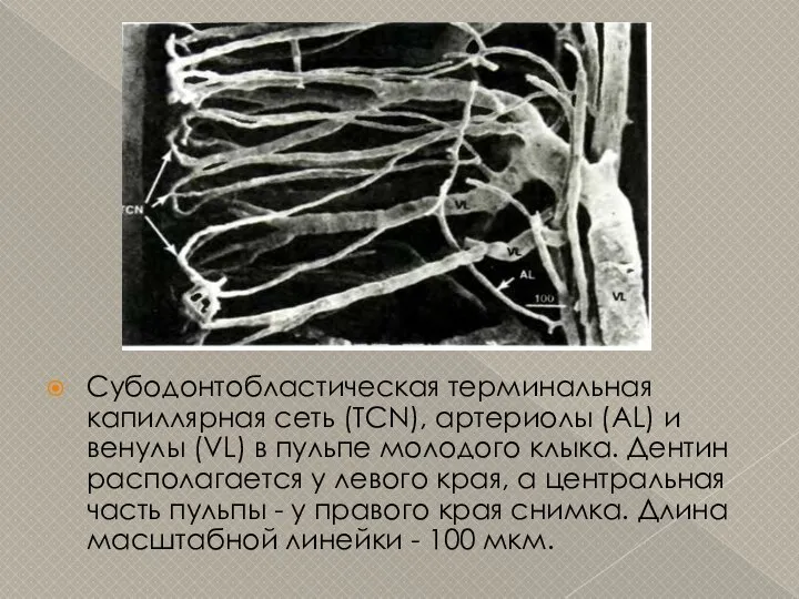 Субодонтобластическая терминальная капиллярная сеть (TCN), артериолы (AL) и венулы (VL) в