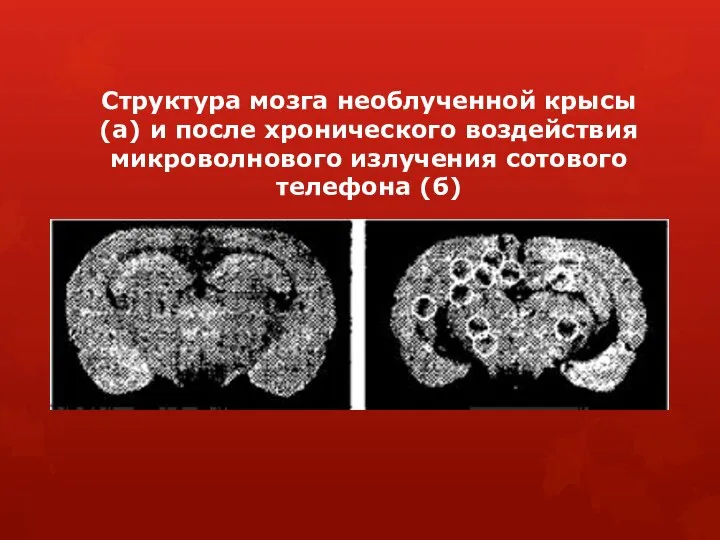 Структура мозга необлученной крысы (а) и после хронического воздействия микроволнового излучения сотового телефона (б)