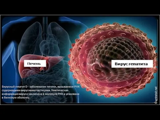 Вирусный гепатит D - заболевание печени, вызываемое РНК содержащими вирусными частицами.