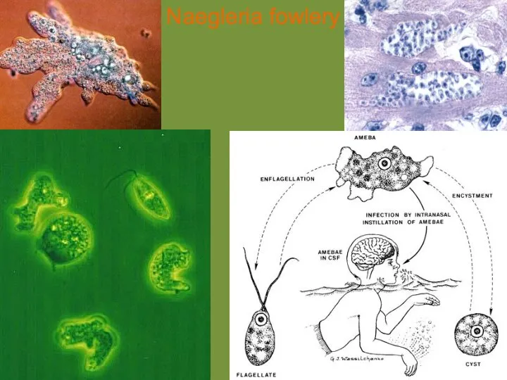 Naegleria fowlery