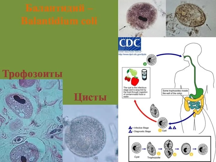 Цисты Трофозоиты Балантидий – Balantidium coli Балантидиаз