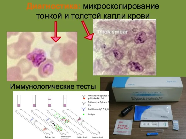 Диагностика: микроскопирование тонкой и толстой капли крови Иммунологические тесты