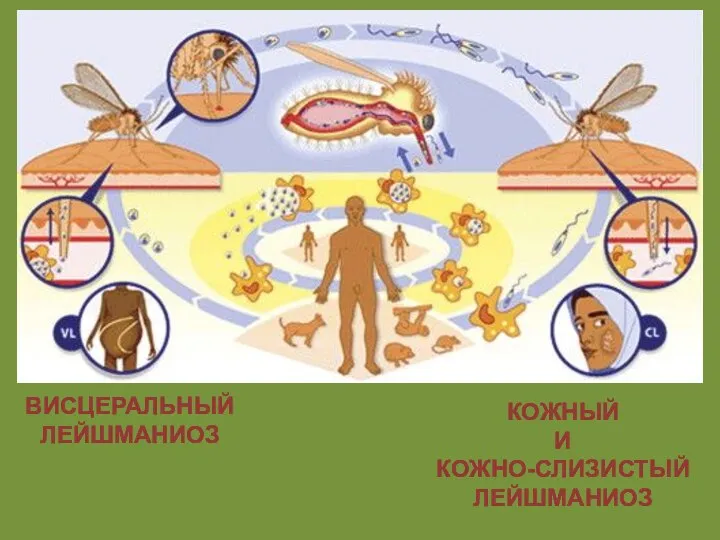 ВИСЦЕРАЛЬНЫЙ ЛЕЙШМАНИОЗ КОЖНЫЙ И КОЖНО-СЛИЗИСТЫЙ ЛЕЙШМАНИОЗ