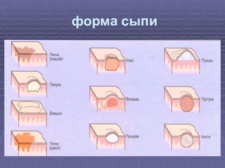 форма сыпи