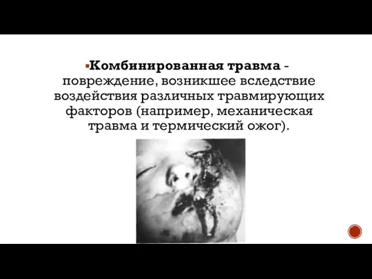 Комбинированная травма - повреждение, возникшее вследствие воздействия различных травмирующих факторов (например, механическая травма и термический ожог).