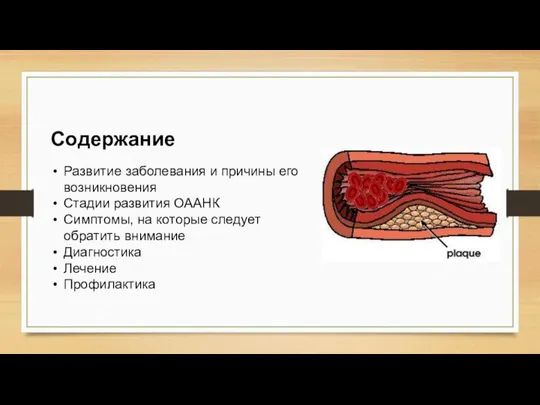 Содержание Развитие заболевания и причины его возникновения Стадии развития ОААНК Симптомы,