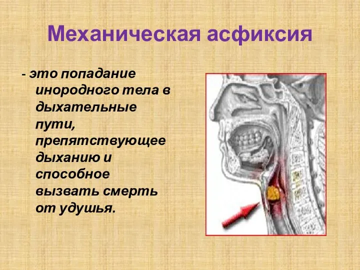 Механическая асфиксия - это попадание инородного тела в дыхательные пути, препятствующее