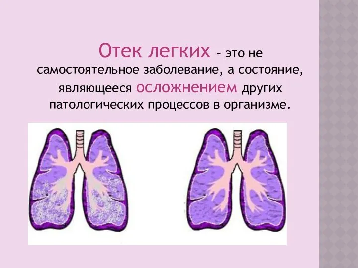 Отек легких – это не самостоятельное заболевание, а состояние, являющееся осложнением других патологических процессов в организме.