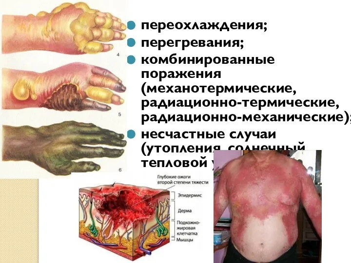 переохлаждения; перегревания; комбинированные поражения (механотермические, радиационно-термические, радиационно-механические); несчастные случаи(утопления, солнечный, тепловой удар).