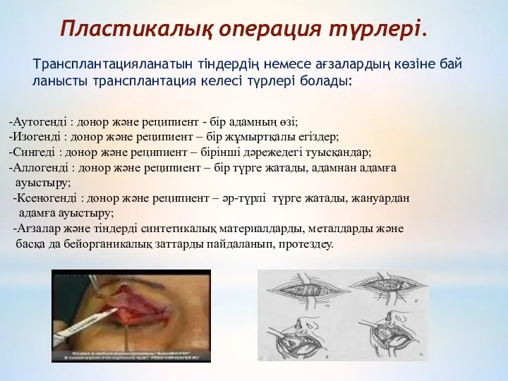 Пластикалық операция түрлері. Трансплантацияланатын тіндердің немесе ағзалардың көзіне бай ланысты трансплантация