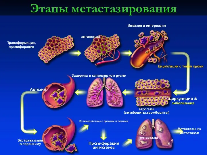 Этапы метастазирования Трансформация, пролиферация ангиогенез Инвазия и интервазия Циркуляция с током